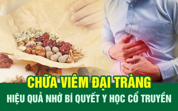 Mục tiêu của việc nghiên cứu bài thuốc chữa bệnh đại tràng là tìm ra bài thuốc trị bệnh tối ưu nhất