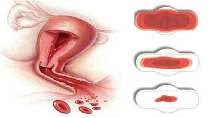 Rong kinh là tình trạng thời gian hành kinh kéo dài quá 7 ngày khiến nhiều chị em lo lắng