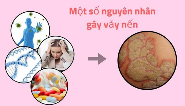 Một số nguyên nhân và yếu tố gây bệnh