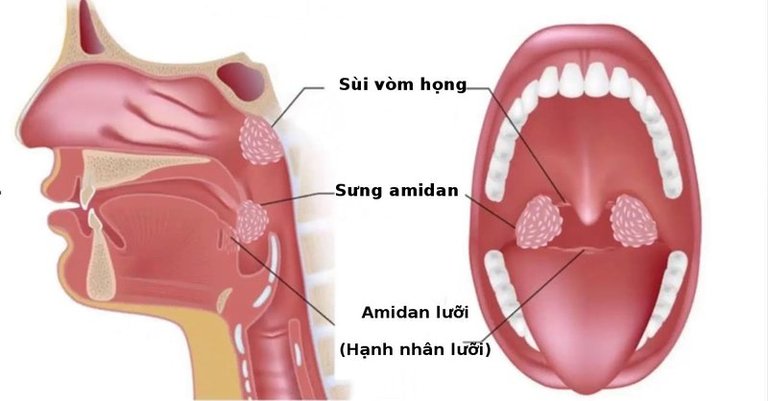 Bệnh tiềm ẩn nhiều nguy cơ biến chứng nguy hiểm