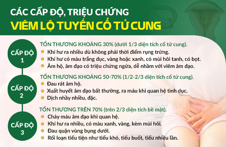 Triệu chứng viêm lộ tuyến theo từng cấp độ