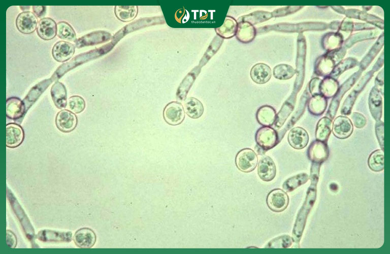 Trên cơ thể con người, nấm candida tồn tại dưới dạng vô hại